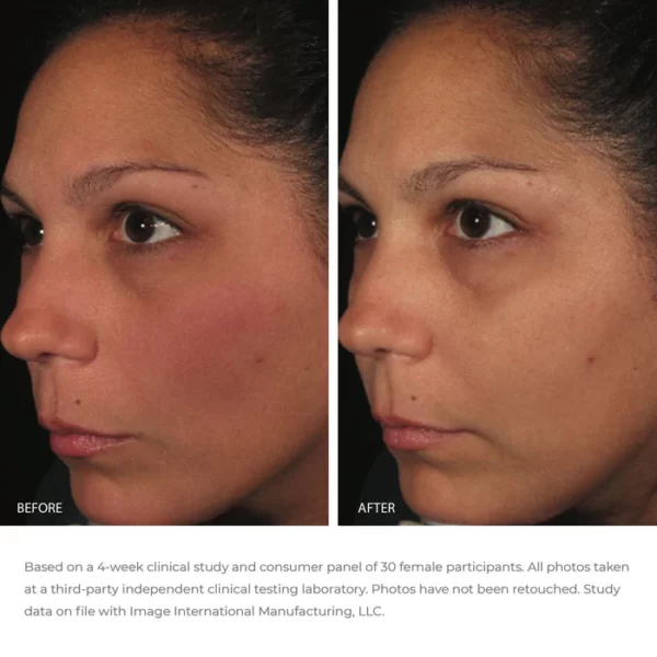 ORMEDIC balancing antioxidant serum - Image 3