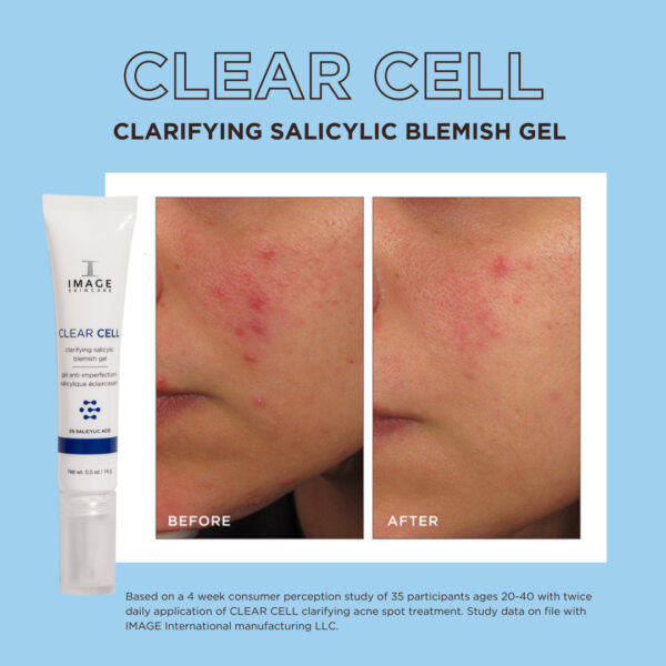 CLEAR CELL clarifying salicylic blemish gel - Image 3